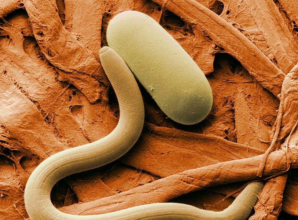 hoe ontstaat een worminfectie 