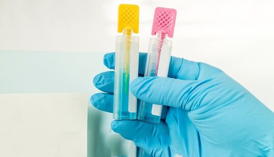 Parasiet diagnostiekmethoden